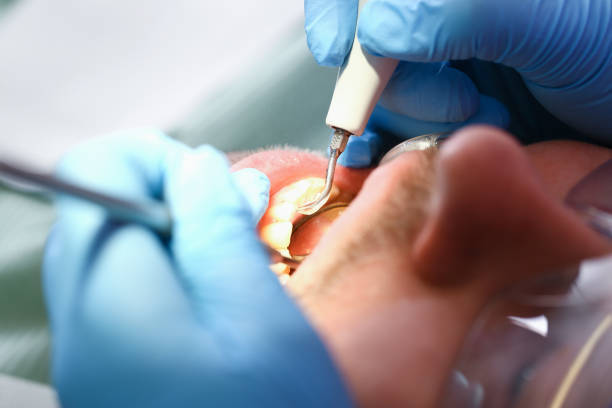 Best Emergency Broken Tooth Repair in Cache, OK